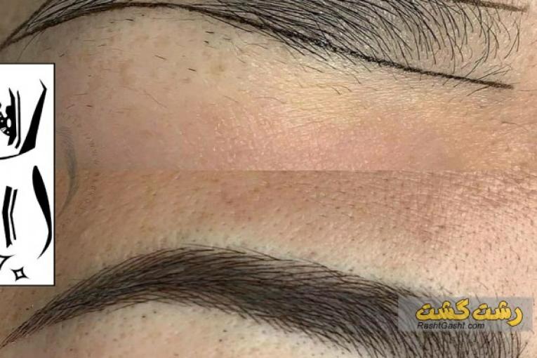 میکروبلیدینگ