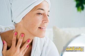 ارتباط بین استرس و پوست