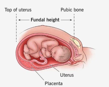 تصویر شماره محدودیت رشد داخل رحمی جنین