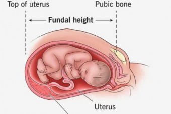 محدودیت رشد داخل رحمی جنین
