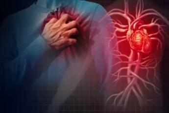 سندرم بروگادا