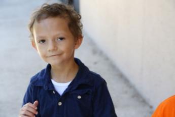 سندرم نونان