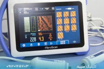 تشخیص بیماری های کبدی با فیبرو اسکن