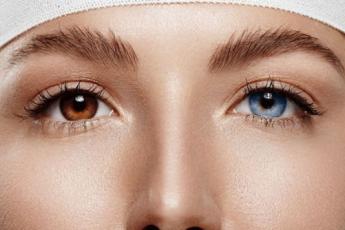 جراحی تغییر رنگ چشم