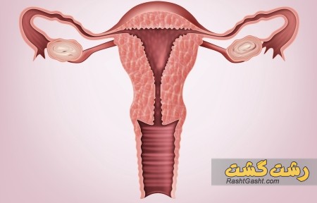 تصویر شماره نبات در واژن