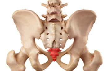 درد دنبالچه