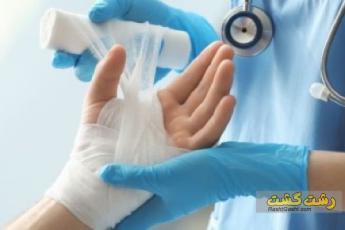 درمان سوختگی با بخار