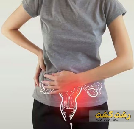 تصویر شماره درد رحم در بارداری
