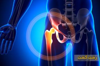 درد باسن و لگن