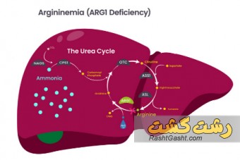نقص آرژیناز 
