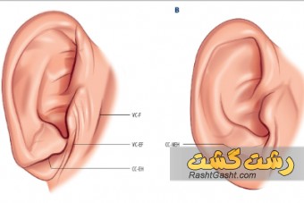 چین لاله گوش