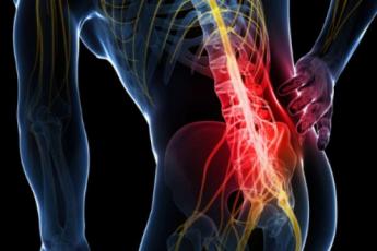 کمر درد عصبی