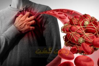 حذف لخته خون با رژیم غذایی