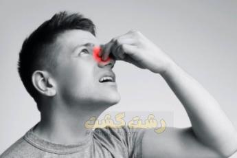 سوزش بینی