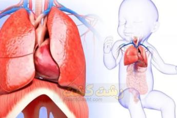 ناهنجاری ریه در نوزادان