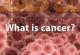 علایم سرطان