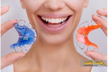 انواع ارتودنسی