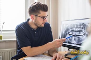 ایمپلنت دیجیتال