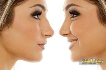 عمل بینی و مراحل آن