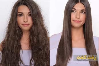 هایپر استریت مو