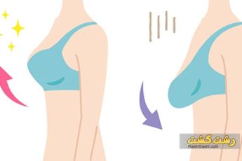 لیفت سینه با نخ