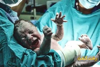 پایین بودن جفت