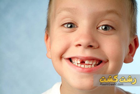 تصویر شماره غیبت دندانی
