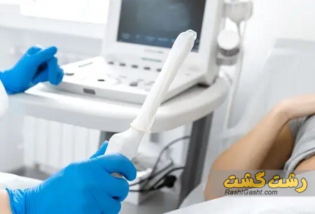 تصویر شماره سونوگرافی واژینال در بارداری