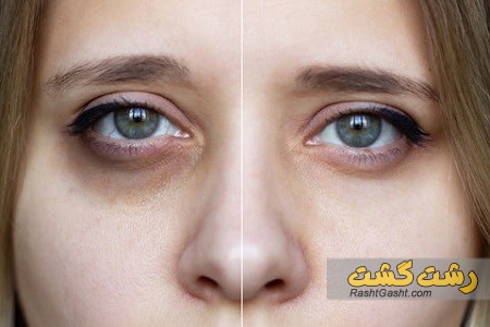 تصویر شماره درمان مشکلات دور چشم با روغن های طبیعی