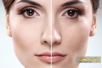 پاک سازی پوست