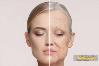 لیفت یا تزریق چربی صورت