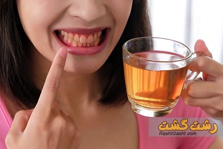 تصویر شماره تغییر رنگ دندان با چای