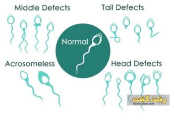 ویژگی های اسپرم ضعیف