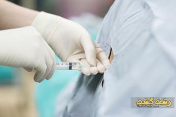 سردرد اپیدورال