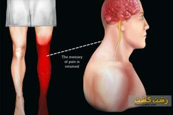 درد خیالی چیست ؟