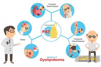 بیماری دیس لیپیدمی