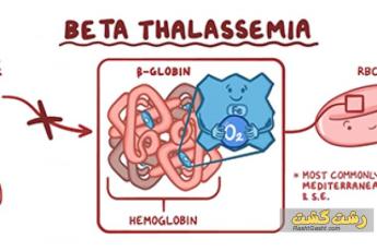 زندگی با بتا تالاسمی