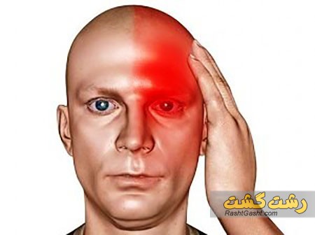 تصویر شماره درمان سر درد