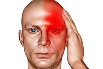 درمان سر درد